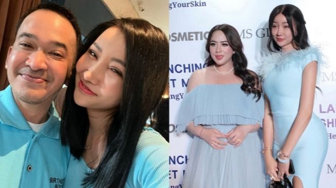 7 Potret Lucinta Luna Usai Oplas, Makin Cantik dan Akrab dengan Rekan Artis