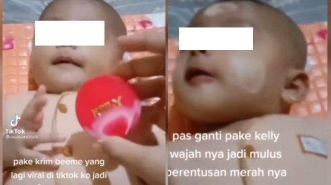 Klaim Bikin Mulus dan Tak Beruntusan, Video Ibu Oleskan Krim Kelly ke Wajah Bayi Tuai Kecaman Publik