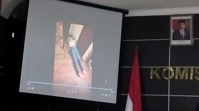 Jasad Brigadir J ditampilkan dalam konferensi pers di Kantor Komnas HAM (PMJ News)