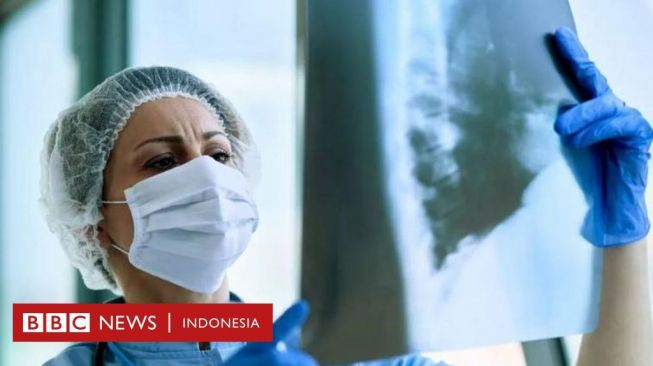 Pneumonia Misterius di Argentina Pernah Muncul di Bali dan Tangerang