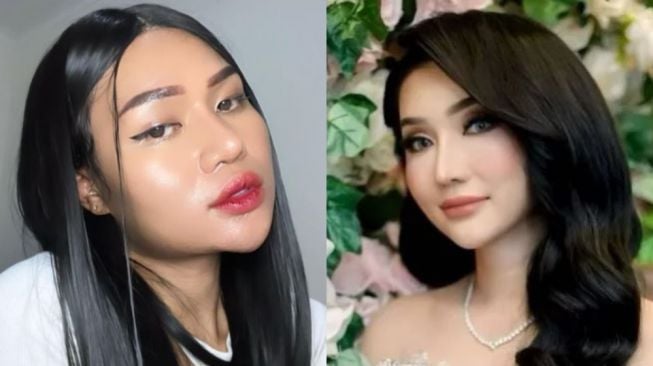 TikToker Popo Barbie Operasi Plastik, Warganet Bandingkan dengan Lucinta Luna