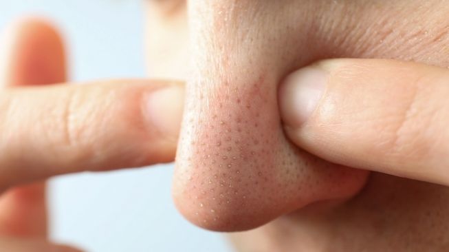 Apa Saja Produk Skincare untuk Menghilangkan Komedo Hitam? Ini 7 Rekomendasinya