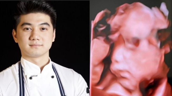 Unggah Potret USG Bayi, Chef Arnold Bagikan Kabar Kehamilan Istri