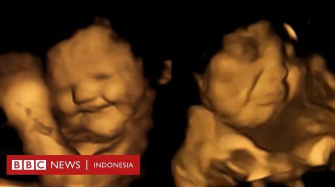 Bayi dalam Kandungan Tersenyum Ketika Merasakan Wortel