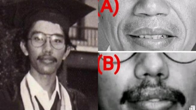 Pakai Ilmu Anatomi, Dokter Tifa Sebut Foto Wisuda Jokowi Tak Serupa: Hidung, Bibir, dan Gigi Dua Orang Berbeda