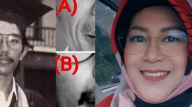 Nyanyian' Kontroversial Dokter Tifa, Terbaru Analisis Hidung Bibir Jokowi  Beda