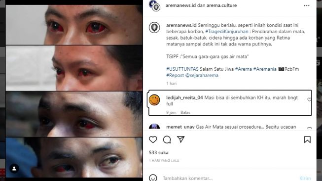 Kondisi Korban Selamat Tragedi Kanjuruhan Viral di IG, Mata Merah dan Sesak Nafas, Warganet: Marah Banget