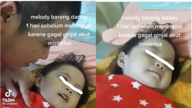 Terbaring Lemas, Bocah Perempuan Meninggal Dunia Diduga Karena Gagal Ginjal Akut Misterius