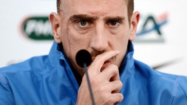 Resmi Gantung Sepatu, Ini Kisah Tragis Codet di Wajah Franck Ribery