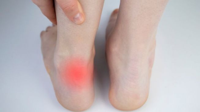 Kaki Sering Berkedut, Ternyata Ini Alasan dan Penyebabnya