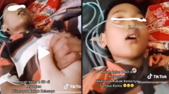 Fakta-Fakta Bocah SD di Malang Dibully sampai Koma: Diseret Kakak ke Bendungan
