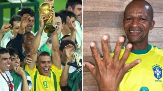 Penggemar Brasil Pemilik 6 Jari Berharap Negaranya Raih Gelar ke-6 Piala Dunia di Qatar