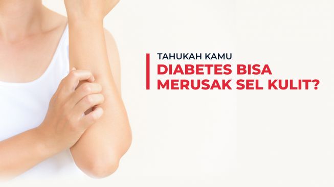 Tahukah Anda ternyata diabetes bisa merusak sel kulit. (Foto: Dok. CNI)