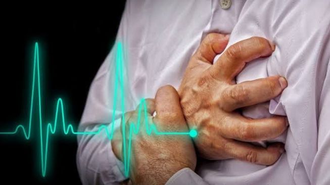 Benarkah Obat-obatan Herbal Bisa Atasi Serangan Jantung? Ini Penjelasan Dokter