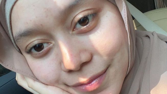 10 Potret Istri Pesinetron Tanpa Makeup, Cantik dan Tetap Menawan