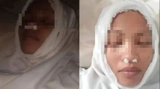 Ditagih Utang Rp 4,2 Juta, Perempuan Ini Nekat Palsukan Kematian Hingga Foto Pakai Kain Kafan