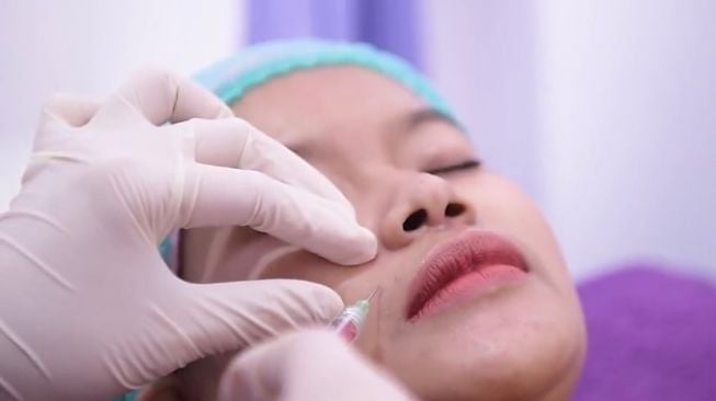 Perawatan kecantikan dengan botox untuk menghilangkan kerutan atau kulit kendur di pipi. (Foto: Dok. Klinik Jasper Skincare)