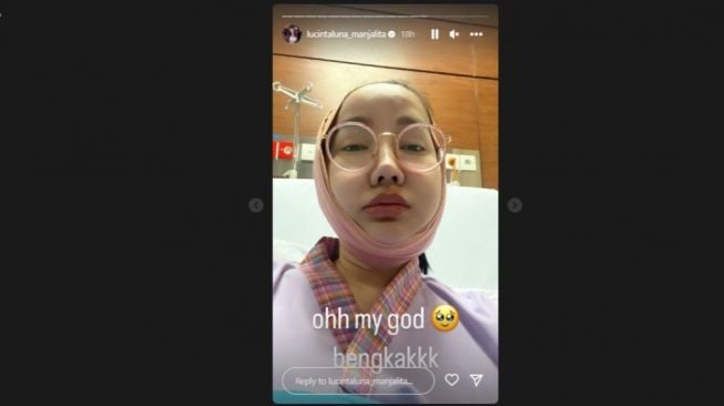 Muka Lucinta Luna Bengkak, Netizen Malah Tuding Gegara Efek Samping Potong Rahang