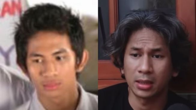 Pilu! Begini Kabar Terbaru Aji Yusman Bintang Sinetron Inikah Rasanya, Tak Mampu Bayar Biaya Operasi