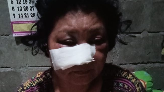Miris! Korban Klitih di Gunungkidul Harus Pulang Paksa dari Rumah Sakit karena Tak Punya Uang untuk Operasi