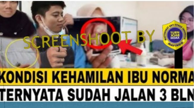 CEK FAKTA: Benarkah Ibu Norma Risma Hamil 3 Bulan Anak Rozy Zay Hakiki?