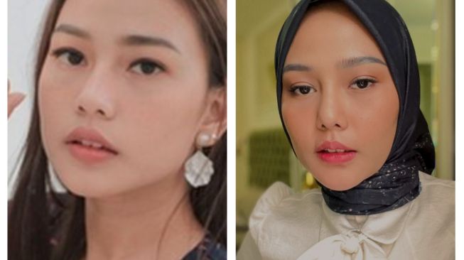 Foto Artis Sebelum dan Sesudah Oplas (Instagram/@daraarafah) 