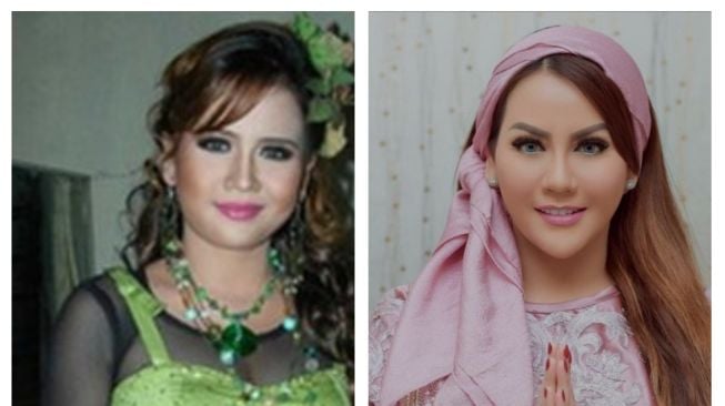  Foto Artis Sebelum dan Sesudah Oplas (Instagram/@nitatalia.real) 