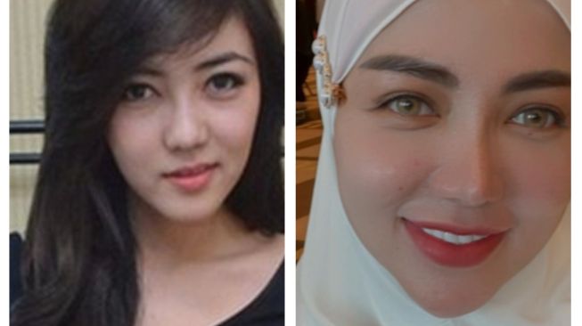  Foto Artis Sebelum dan Sesudah Oplas (Instagram/@bellashofie_rigen) 