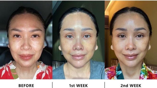 8 Transformasi Titi DJ yang Makin Awet Muda Usai Operasi Antiaging di Korea