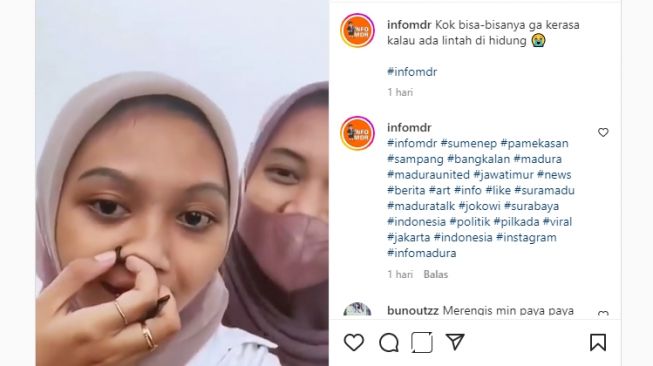 Duuh! Merinding, Cewek Ini Tak Sadar Hidungnya Kemasukan Lintah