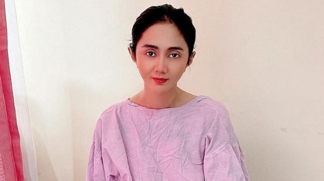 Artis Berjuang Lawan Kanker Payudara (Instagram/@aidasaskia.new)