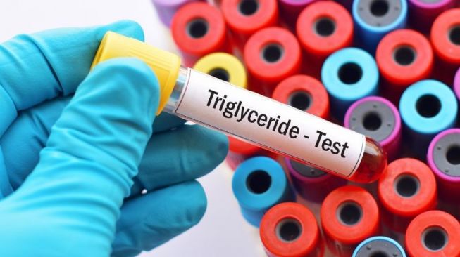 Apa Perbedaan Antara Trigliserida dan Kolesterol?