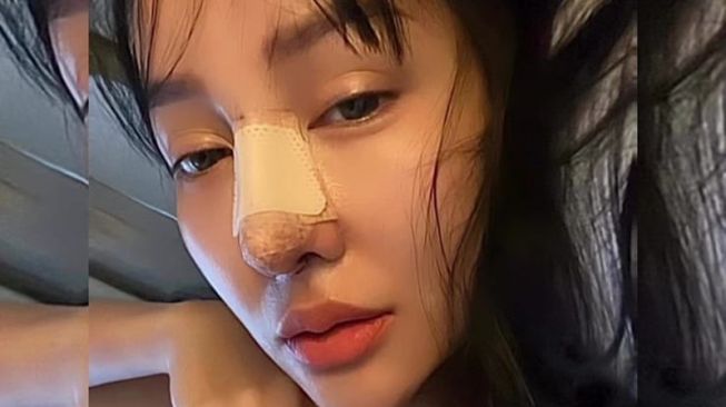 Ada yang Bilang Hidung Baru Lucinta Luna Kegedean, Netizen: Biarin Aja