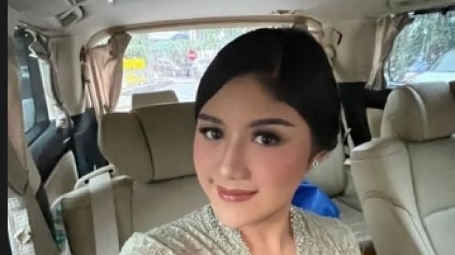 Momen Erina Gudono Hadiri Wisuda Adik (Instagram/@shaniagudono)