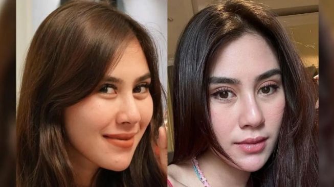 Syahnaz Adik Raffi Ahmad Kelihatan Lebih Mancung, Warganet Curiga Oplas Hidung