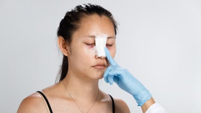 4 Jenis Operasi Hidung yang Enggak Cuma Bikin Mancung, Sudah Tahu Belum?