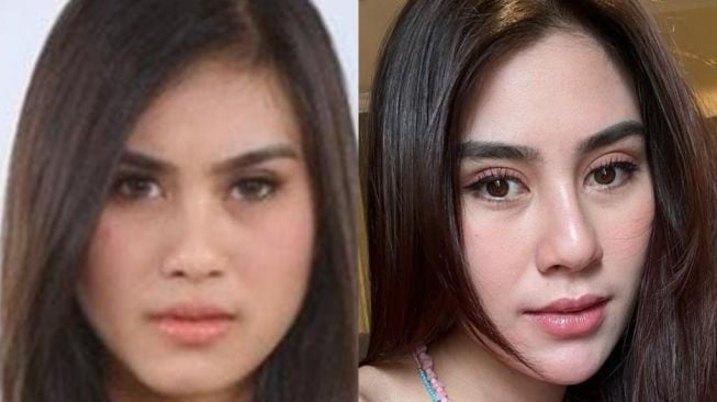 10 Potret Transformasi Syahnaz Sadiqah, Makin Cantik Hingga Dituding Oplas