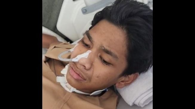 Update Kondisi David Hari Ini: Makin Bagus Responsnya