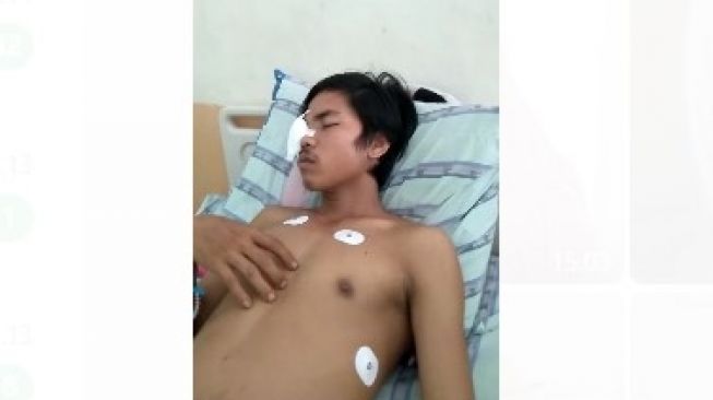 Korban Geng Motor di Kabupaten Gowa Kesulitan Biaya Operasi, Satu Bola Mata Dikeluarkan
