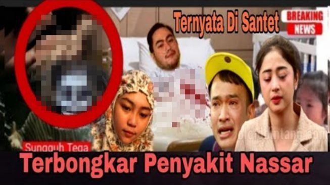 CEK FAKTA: Terbongkar! Nassar Terbaring Kaku di RS Gegara Santet, Benarkah?