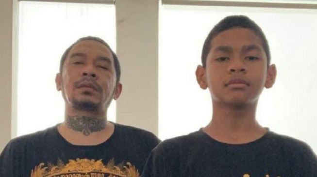 Sudah Lepas Selang Kanul Trakeostomi, Benarkah David Ozora Terancam Buta Warna Setelah Dianiaya Mario Dandy?