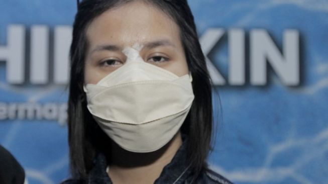 Artis Jalani Operasi Hidung (Suara.com/Oke Atmaja)