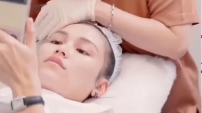 Ayu Ting Ting Lebaran Pakai Hidung Baru Banjir Cibiran: Kok Oplas Semua Bu?