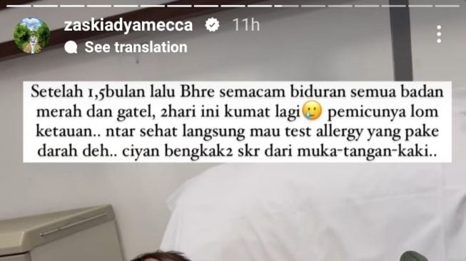 Anak Zaskia Adya Mecca Alami Biduran di Seluruh Badan, Gara-Gara Cuaca Panas?