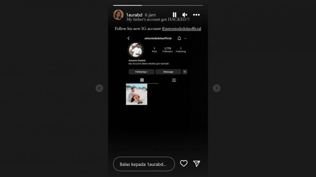Lolly ungkap akun Instagram Antonio Dedola dihack (Instagram/@1aurabd)
