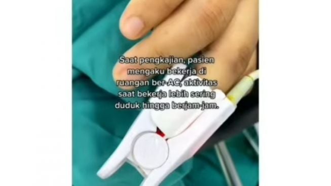 Batu Ginjal Sebesar Jahe Bersarang di Tubuh Wanita, Ini Penyebabnya!