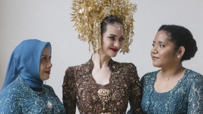 Potret Casey Paquita Adik Enzy Storia (Instagram/@enzystoria) 