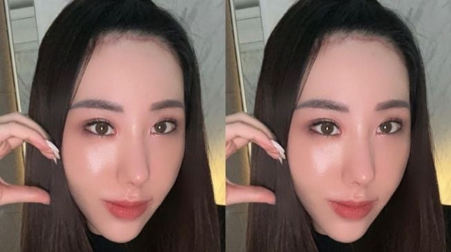 Valerie Laurencia, Selebgram yang Bikin Heboh dengan Konten Operasi Plastik