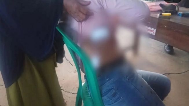 Viral Karyawati di Bekasi Dibacok Begal, Polisi: Korban Belum Lapor, Pelaku Sudah Diidentifikasi