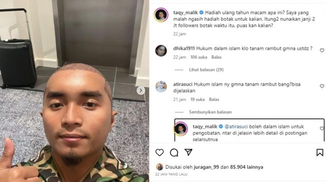 Taqy Malik tampil botak buat transplantasi rambut [Instagram/@taqy_malik]